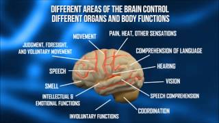 What impairments can occur after a stroke [upl. by Ardyaf]