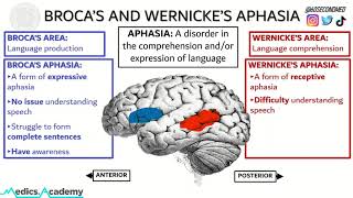 69 SECONDS on BROCAS and WERNICKES APHASIA Never get them mixed up again [upl. by Ahsirahc602]