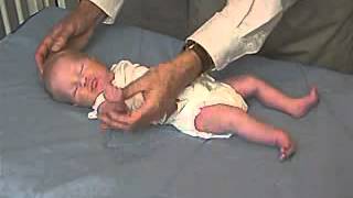 Clinical Pediatrics Hypotonia 1 [upl. by Gussie]