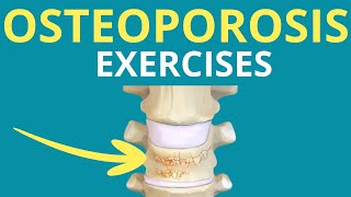 5 Exercises for Osteoporosis [upl. by Cissiee813]