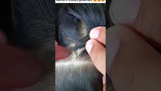 Picking a thousand of lice on hair How to get rid of lice hair wigs newvideolicetok headlice [upl. by Enedan]