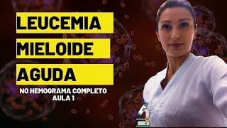 Como Identificar Leucemia Mieloide Aguda no hemograma completo biomedicina hematologia [upl. by Amluz]