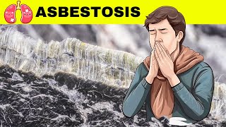 Asbestosis  Causes Pathogenesis Signs amp Symptoms Diagnosis And Treatment [upl. by Nyltiak]