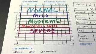 How to Read Your Audiogram [upl. by Rialb620]