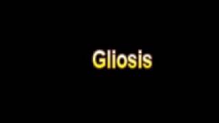 What Is The Definition Of Gliosis  Medical Dictionary Free Online Terms [upl. by Masera]