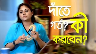 দাঁতের গর্ত কেন হয়  দাঁতের গর্ত হলে আপনাকে যা অবশ্যই করতে হবে  দাঁতের ব্যাথায় করণীয় [upl. by Efrem]