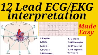 12 lead ECGEKG interpretation made easy with simple steps  12 lead ECG  ECG interpretation  ECG [upl. by Bogosian]