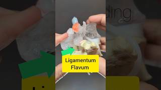 Ligamentum Flavum Modelling  Dynamic Disc Designs [upl. by Berget]