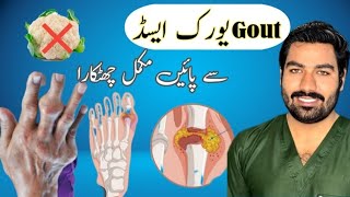 High Uric Acid ko normal kaisay karain Gout pay general discussion DrMHussan [upl. by Anyzratak]