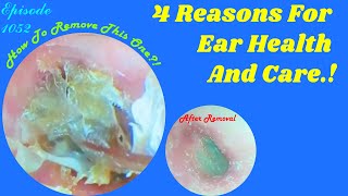 4 Reasons For Ear Health And Care  1052 earwax [upl. by Noyes178]