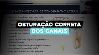 Como Fazer Obturação dos Canais Radiculares Guia Completo de Endodontia [upl. by Rory368]