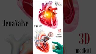 JenaValve animation 3d short  Learn Biology with Aliya [upl. by Calan540]