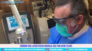 Get Clear Skin Erbium Yag Lasers Breakthrough Acne Scars Treatment acnetreatment lasertreatment [upl. by Plate]