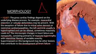 LEFT SIDED HEART FAILURE [upl. by Tasia143]