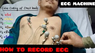 How To Record ECG  ECG leads Color Coding And Placement Location  ECG Machine [upl. by Soloman]