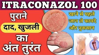 Itraconazole Capsule 200100mgitratek Capsule Use Dose Side Effects and Price in Hindi [upl. by Nitreb]