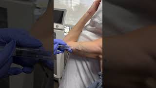 Tattoo Removal Progress Video [upl. by Enovaj]