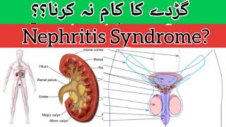 Nephrotic syndrome नेफ्रोटिक सिंड्रोम  Causes Symptoms Treatment in HindiUrdu [upl. by Philippa]