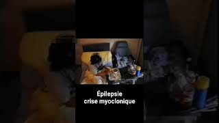 Epilepsie  crise myoclonique du réveil [upl. by Metah14]