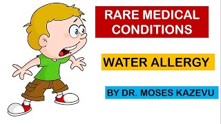 Water Allergy Rare Medical conditions [upl. by Danzig]