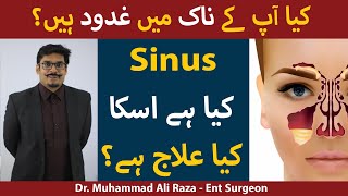 Sinus Infection Ka Ilaj  Naak K Gadood K Ilaj  Treatment of Nasal Polyps In UrduHindi [upl. by Yrotciv335]