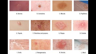 Skin Lesions with defination [upl. by Vasilis829]