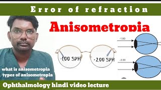 anisometropia  error of refraction  what is anisometropia  anisometropia  optometryhindi [upl. by Dlanigger798]