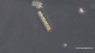 Chaetoceros diatomeas  diatoms [upl. by Allicerp]