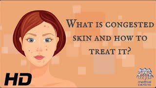 What Is Congested Skin And How To Treat It [upl. by Alfeus]