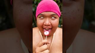 ToRung comedy 😂protect the lollipop🍭 [upl. by Eduj]