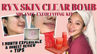 HOW I GOT RID OF MY PIMPLES  RYX SKIN CLEAR BOMB 1MONTH EXPERIENCE ampHONEST REVIEWTIPS  Verra Jane [upl. by Dhiman]