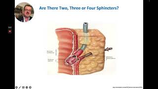 ERCP  Basic Principles of Biliary Sphincterotomy [upl. by Jim]