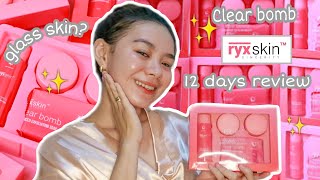 RYX SKIN SINCERITY CLEAR BOMB 12 DAYS REVIEW  Glad Ocampo [upl. by Eiuol270]