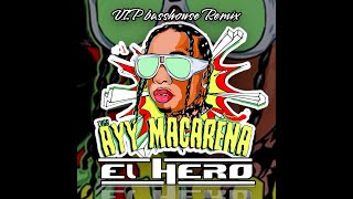 Tyga  Ayy Macarena Basshouse Remix  VIP DJ EL HERO [upl. by Cromwell]