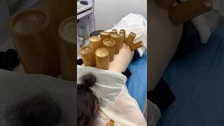 Cupping therapy restores health massage relax skincare asmr food cuppingtherapy [upl. by Dlareg]