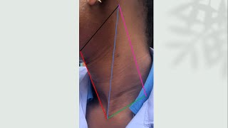 ANATOMY OF THE POSTERIOR NECK TRIANGLE [upl. by Ayotak]