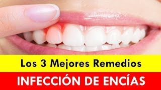 Qué Es Bueno Para La Infección De Las Encías 3 Mejores Remedios [upl. by Rhett848]