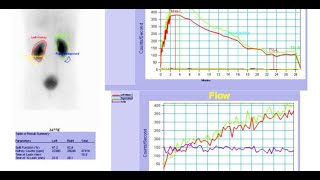 Renal scintigraphy Radiopharmaceuticals MCQ RenalScintigraphy renal scfhs nuclearmedicineMCQ [upl. by Niki]