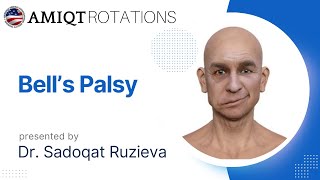 Bells Palsy by Dr Sadoqat Ruzieva [upl. by Llenaj943]