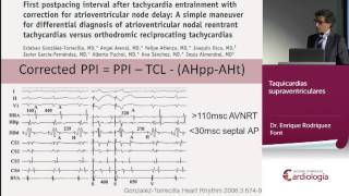 Taquicardias supraventriculares [upl. by Doi]