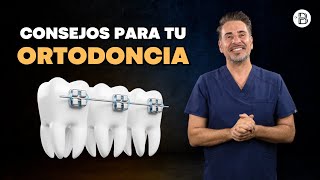 Consejos para tu ORTODONCIA con el Dr Blanco 💡🦷 [upl. by Leamse]