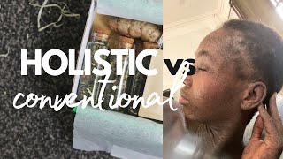 LIVING WITH ECZEMA EPISODE 2 HOLISTIC OR CONVENTIONAL [upl. by Wiltsey827]