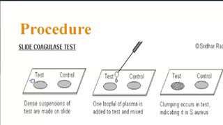 Biochemical Tests  Catalase Coagulase Citrate utilization Indole Oxidase Methyl Red Urease [upl. by Mcgray279]