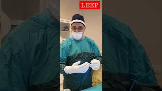 LEEP 💥 Loop Electrosurgical Excision Procedure [upl. by Morocco745]