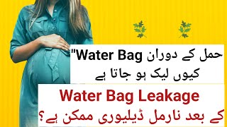 Water Bag Leakage  When to Visit Hospital Symptoms Before delivery In Urdu Hindi [upl. by Yanrahs568]