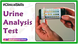 Urine analysis test procedure  Biochemistry Practicals [upl. by Hewe]