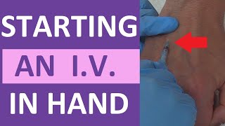 How to Start an IV  IV Catheter Insertion amp Flush Technique in Hand  Nursing Skill [upl. by Andris]