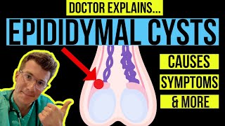 Doctor explains TESTICULAR LUMPS PART 1  EPIDIDYMAL CYSTS causes symptoms and treatments [upl. by Asilim938]