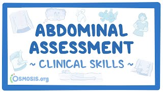 Abdominal Assessment Clinical Skills [upl. by Aida]