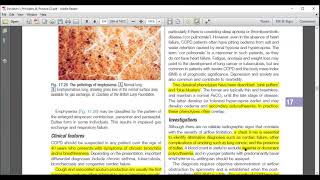 COPD  Respiratory Medicine  UrduHindi  Davidson Medicine [upl. by Sirod589]